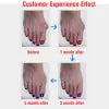 Silicone Toe Relief Sleeves